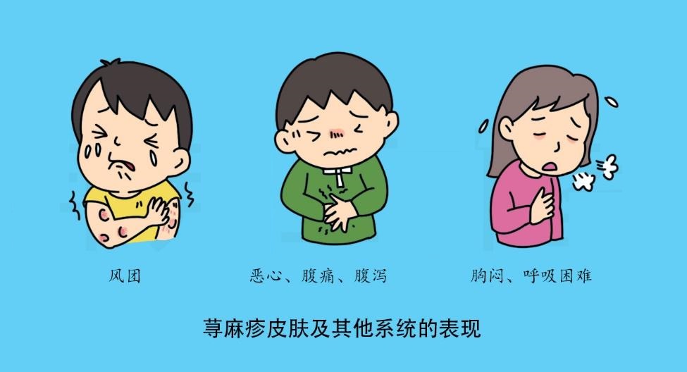 荨麻疹.jpg