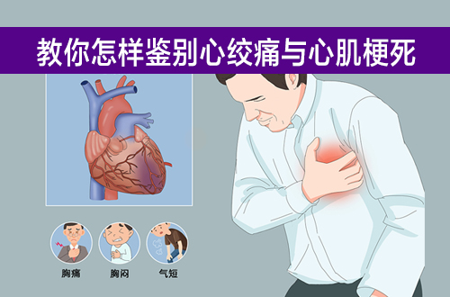 心绞痛01.jpeg