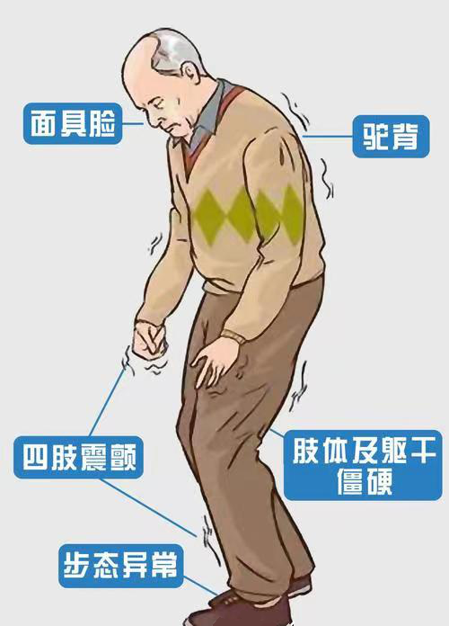 帕金森02.png