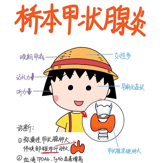 桥本甲状腺炎.png